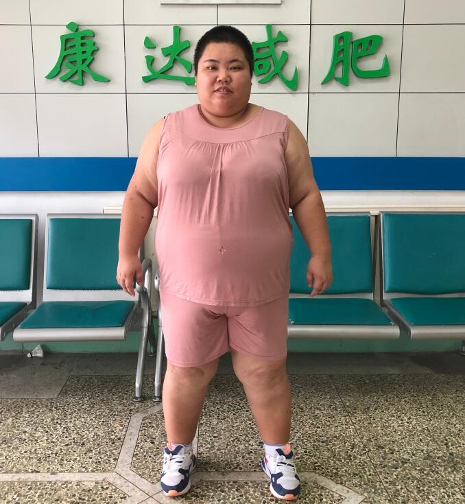 贵州陈前芳在长春康达减肥125斤1