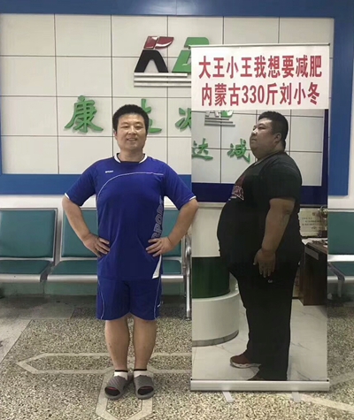 刘小冬减肥 330斤的他成功在长春康达医院瘦身