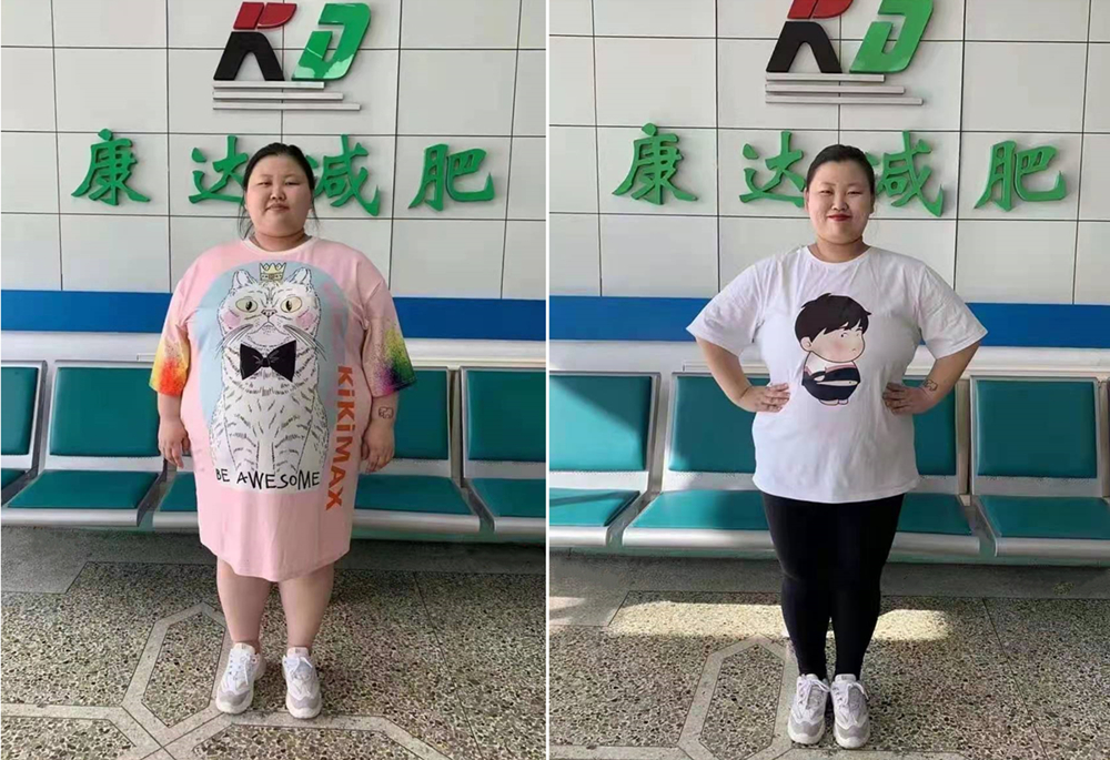湖南姑娘在康达四个月瘦下80斤_长春减肥1